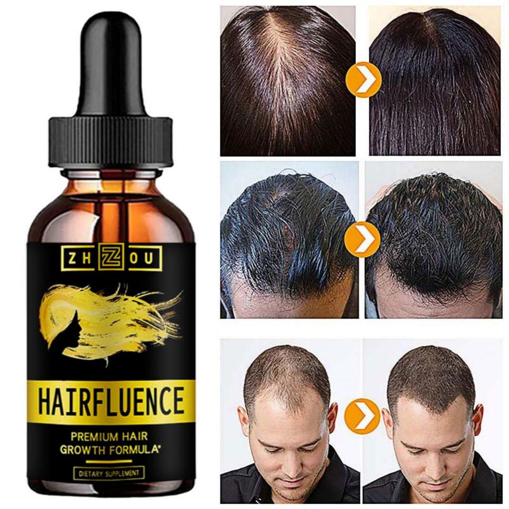 5 мл/15 мл/30 мл/50 мл/сыворотка для роста волос продукт по уходу за волосами сыворотка для волос быстрые волосы