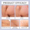 Улучшенный силиконовый гель для кожи, нежное увлажнение и осветление растяжек, осветление тонких линий и удаление геля для разглаживания кожи, 30 г