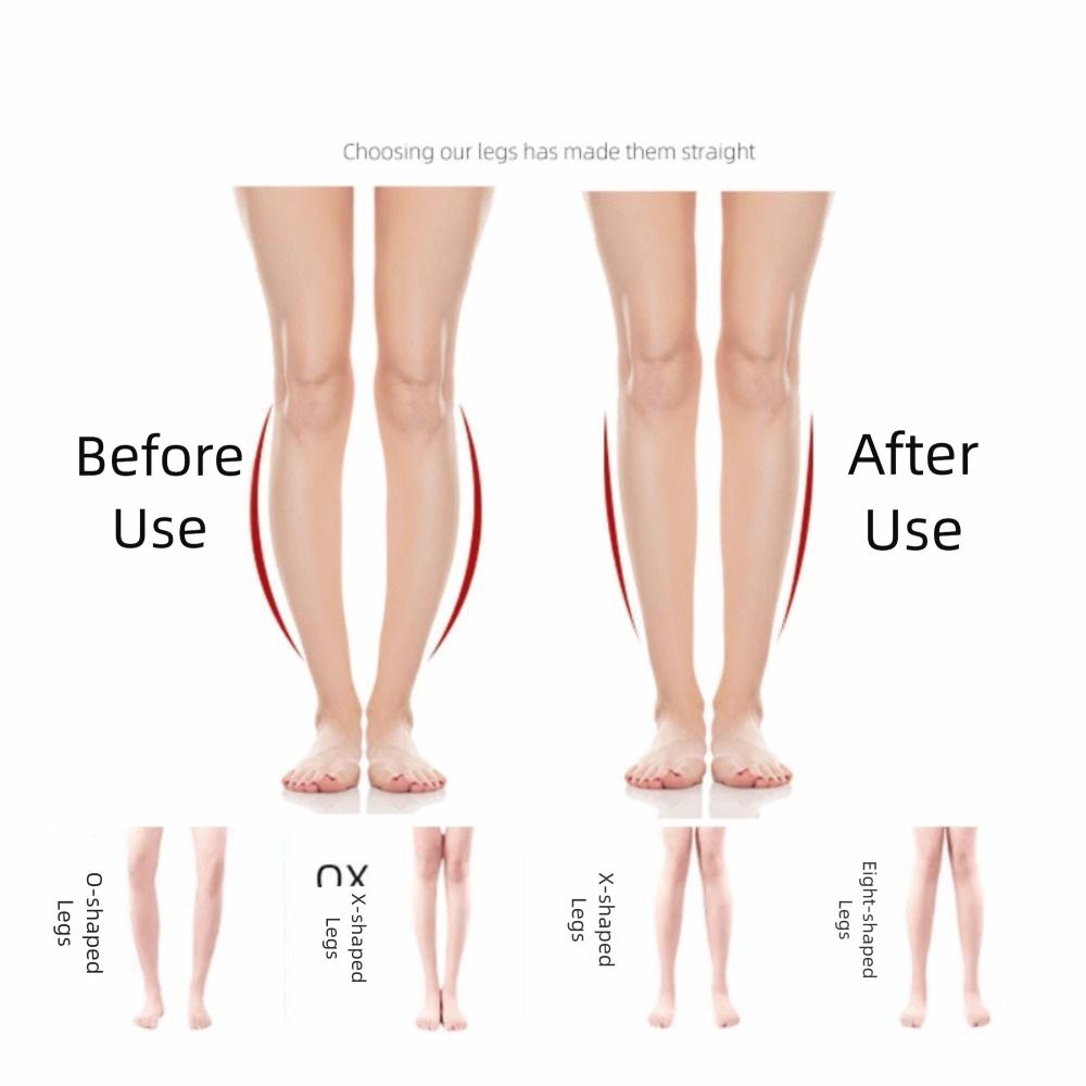 НОВЫЕ Силиконовые Вставки для Обуви Нескользящие Корректирующие Стельки для Ног O/X-типа Поддержка Свода Стопы Мягкий Клин под Пятку Мужские Женские