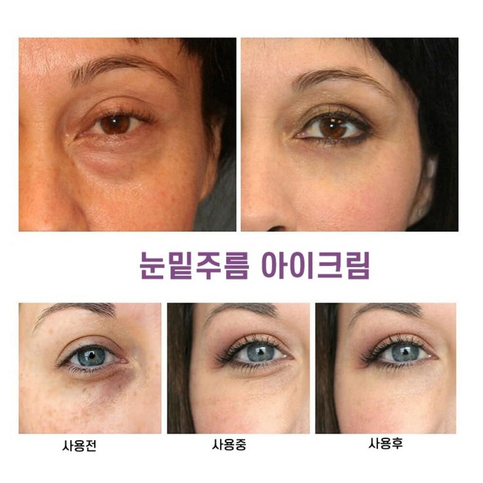 [Utherable] 900 Shots Intense Eye Lifting Cream (15g) - Derm Recommended