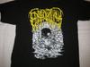 Epicardiectomy Band Tour Gift For Fan All  Unisex T-shirt