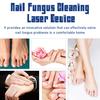 Лазерное устройство для очистки ногтей от грибка ногтей Простое в эксплуатации устройство для терапии синим светом Инфракрасные холодные лазеры Устройство для ухода за ногтями