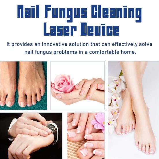 Лазерное устройство для очистки ногтей от грибка ногтей Простое в эксплуатации устройство для терапии синим светом Инфракрасные холодные лазеры Устройство для ухода за ногтями