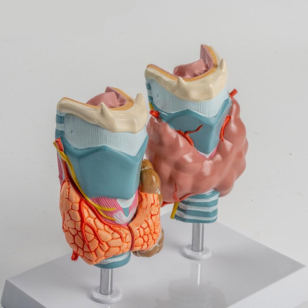 Патологическая анатомическая модель щитовидной железы со съемными частями Патологическая анатомическая модель щитовидной железы и гортани для изучения заболеваний