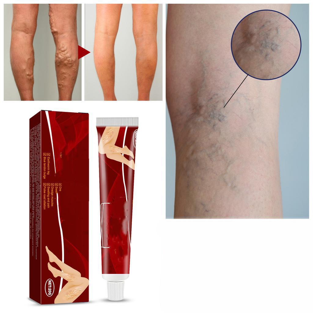 Крем для нормализации цвета кожи на ногах - 1 шт.