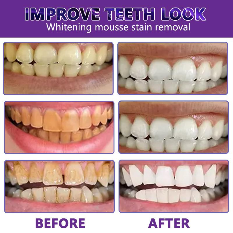 Гель для чистки зубов Tooth Pen V34 Yellow Tooth Stain Cleaning Гель для ухода за полостью рта мгновенно отбеливает зубы, глубоко очищает, удаляет пятна и освежает дыхание дома или в дороге!