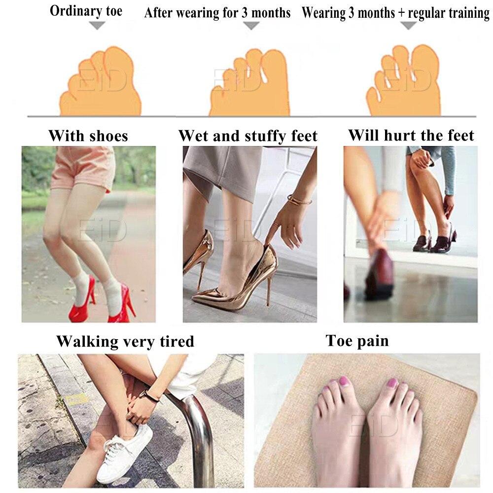 Ортопедические вставки EiD, корректор вальгусной деформации, подушечка-сепаратор для пяти пальцев, силиконовые подушечки для передней части стопы, хлопковые стельки для большого пальца, подушка