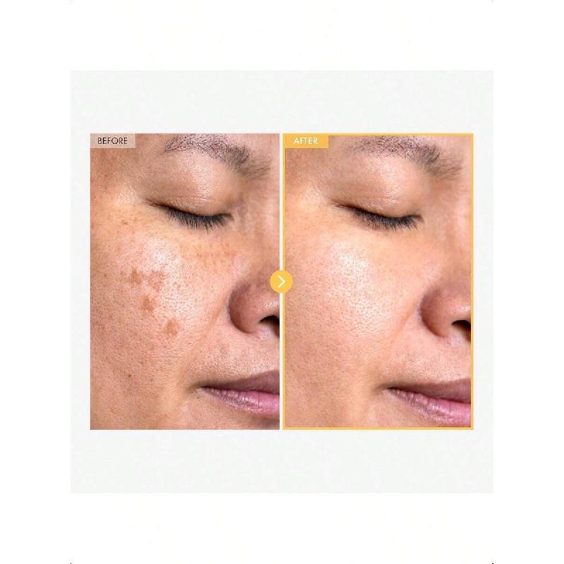 Tosowoong Eraser Liquid Patch 15g | Niacinamide, Tranexamic Acid & Centella Asiatica Extract Infused, Targeted Blemish Treatment