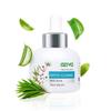OZiva Phyto Cleanse Anti-Acne Face Serum (with Phyto Niacinamide, Tea Tree Oil, Aloe & Neem) for Acne Control and Acne Scar