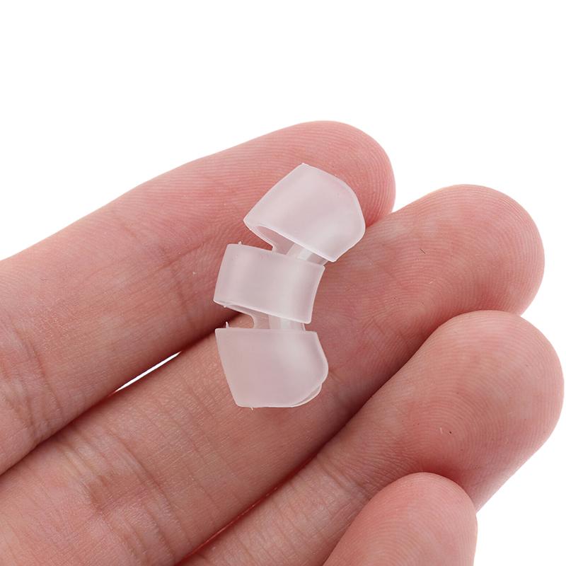 1Pcs Baby Auricle Support External Auricle Corrector Protruding Baby Ear Corrector Baby External Auricle Corrector Ear Pads