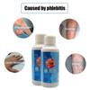 Foot Leg Veins Plaster Leg Spray Spray Swelling Healthy Professional Spray