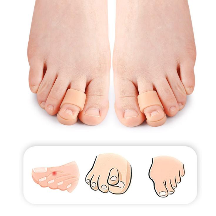 Корректор для разделителя пальцев ног SEBS Toe Pad Straightener Инструмент для ухода за ногами Новый