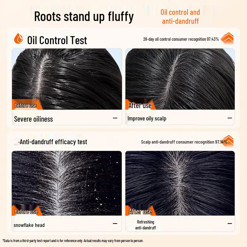 Zhirun Selenium Disulfide Anti-Dandruff Shampoo
