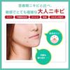 Acne Barrier Medicated Face Wash 100g Adult Acne Herbal Tree Prevention Gentle Pores