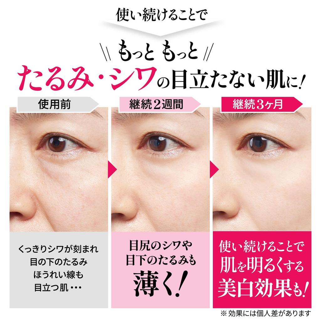 Для использования при лечении морщин Для носогубных складок под между и Восстановление морщин NA 30г [Легкий дом, крем] складки, глаза,