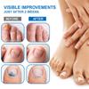 Plaster New Bright Nail Plaster Relieves Onychomycosis And Nail Care