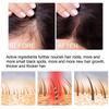 20ml Ginger Spray Regrowth Ginger Spray Fast Hair Growth Fluid Anti Loss Treatment Ginger Essence Prevent Hair Loss Regrowth Ginger Spray