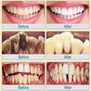 100g Whitening Toothpaste Remover Dental Calculus Whitening Teeth Mouth Odor Removal Bad Breath Preventing Periodontitis