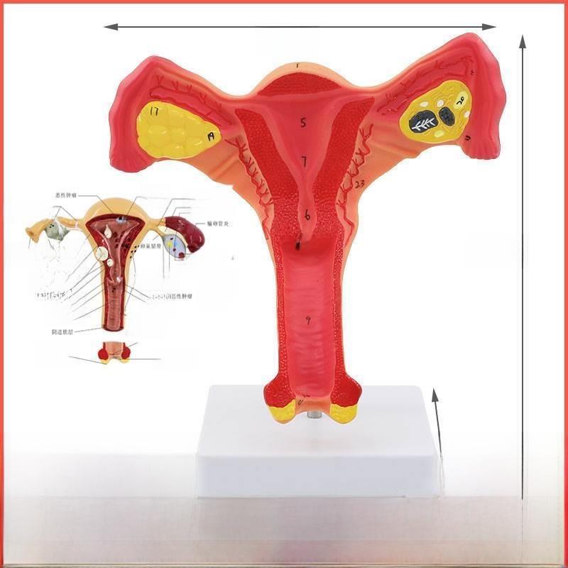 Amical Pathological Model of Human Fem Reproductive Uterus Teaching Model of Vagina Ovary for Gynecological Reproducti...