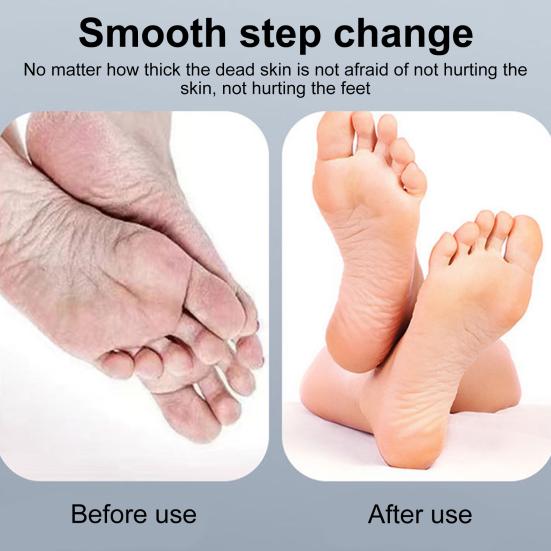 Электрический инструмент для удаления мозолей для ног, профессиональная шлифовальная машина для ног для мужчин и женщин, набор для педикюра, скруббер для ног для удаления мозолей от омертвевшей кожи, инструмент для ухода за ногами с зарядкой через USB