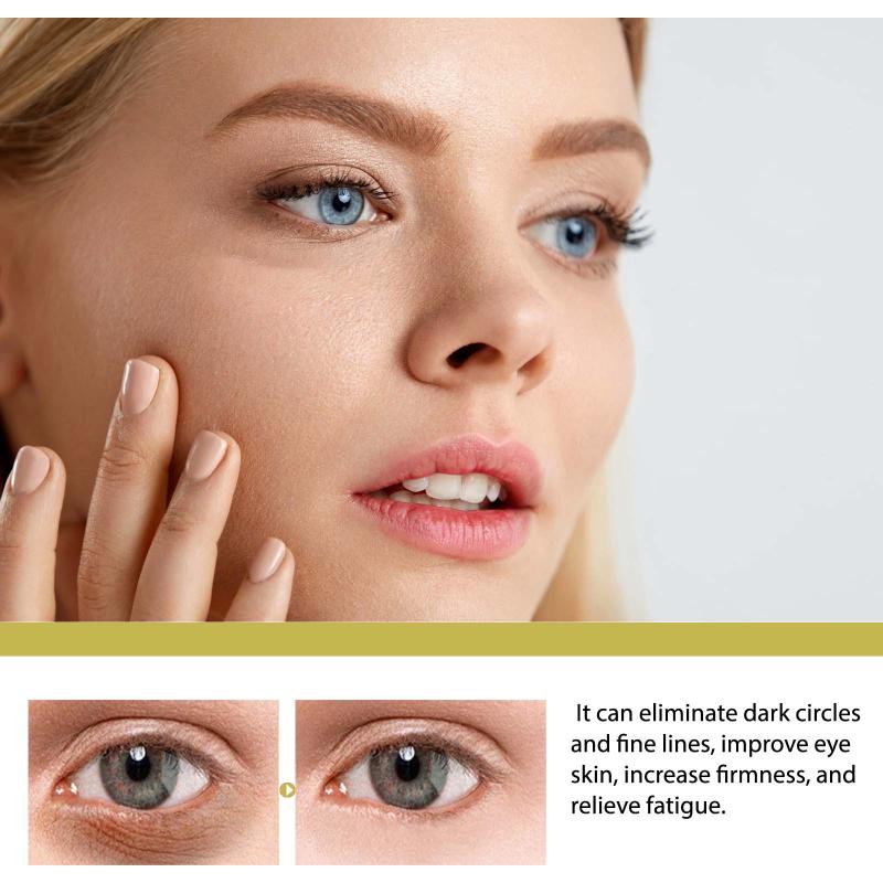 Snail Eye Cream Stick Removing Lightening Dark Circle Remove Eye Bag Anti-Puffiness Firming Fade Fine Lines