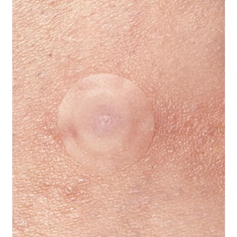 MEDI-PEEL Фито Циканол B5 Точечные патчи S (12 пластырей × 2 упаковки)