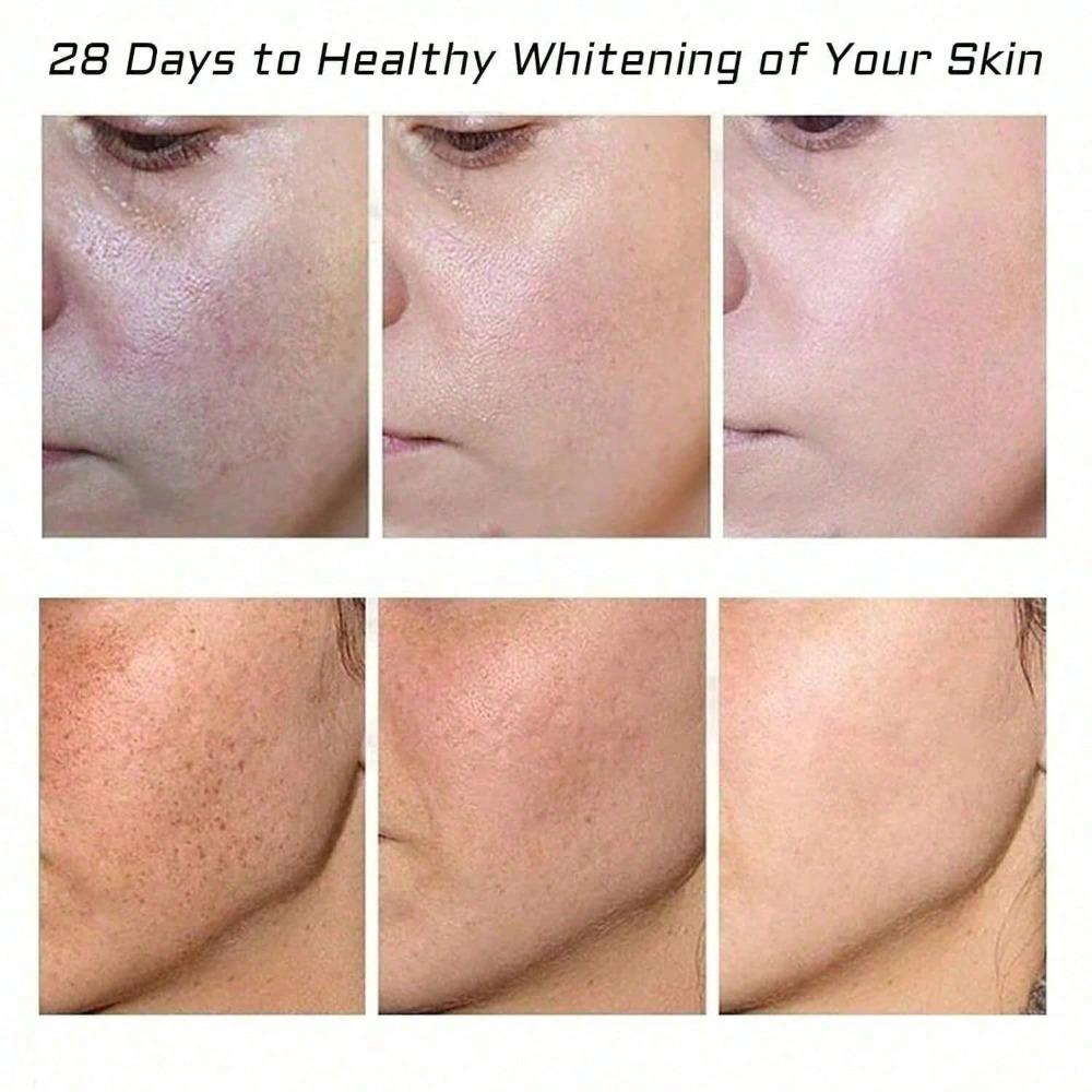 2-Piece Set Whitening And Spot-Removing Cream, Facial Pigment Lightening Cream,For Removing Facial Melasma, Dark Spots, Wrinkles, And Blemishes