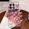 Для Vivo iQOO 15 Чехол Прозрачный Роскошный Милый Заяц с Сердечками Забавный Рисунок Тонкий Мягкий ТПУ Силиконовый Чехол для Телефона Для Vivo iQOO15 Задняя Крышка