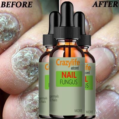 Средство для восстановления ногтей Onycho для рук и ног, подавляющее утолщение ногтей