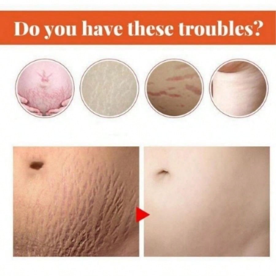 Беременность, укрепляющий восстанавливающий крем для кожи после беременности