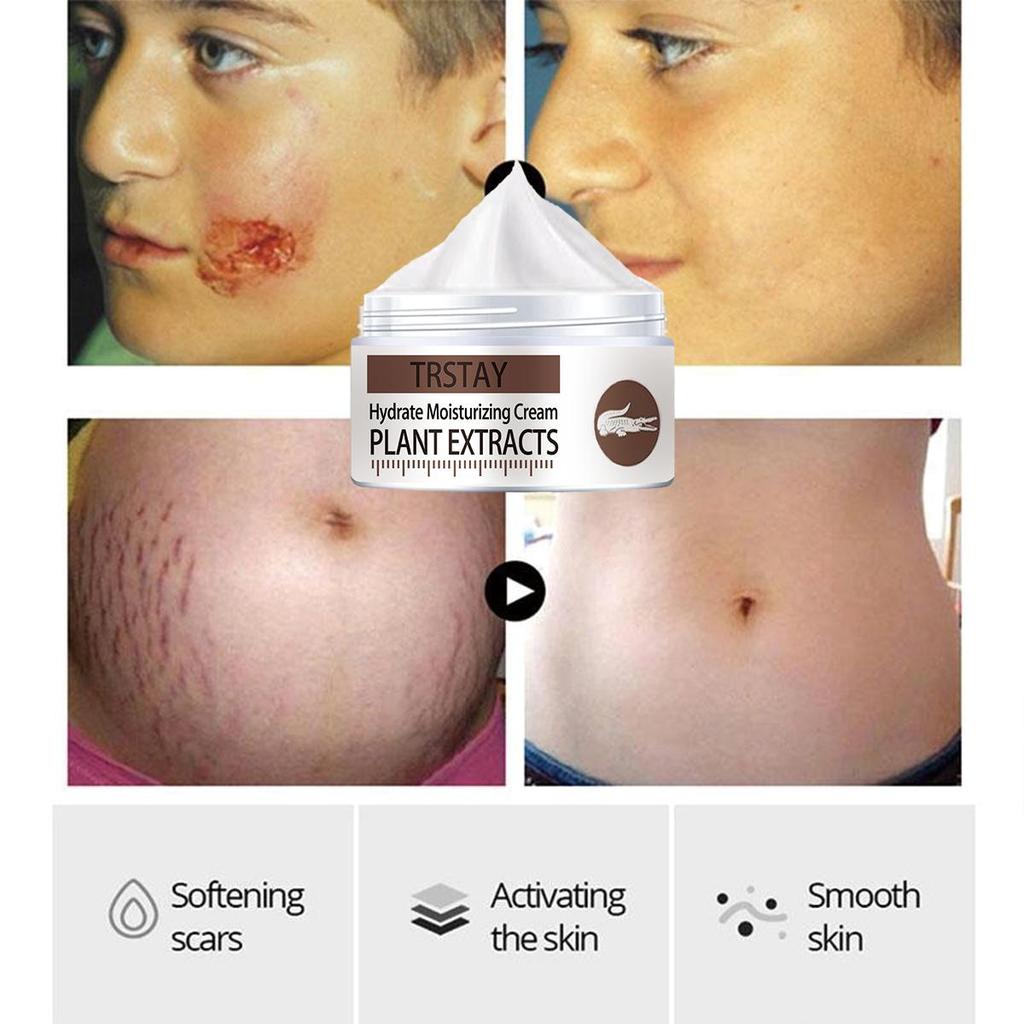 Anti-wrinkle cream lightens scars, improves damaged skin, tightens skin, lightens scars, and makes skin elastic and shiny