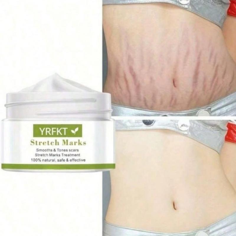 Попрощайтесь с растяжками с нашим мощным кремом Fade