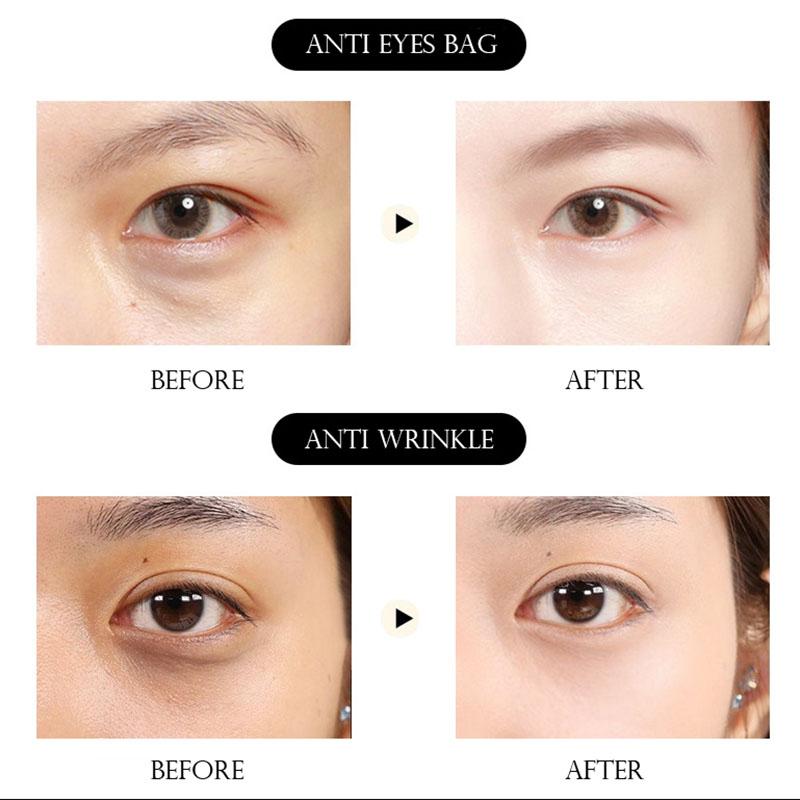 InniCare 60 шт. Коллагеновая маска для глаз против морщин, удаляет темные круги, увлажняющие патчи для глаз, маски для глаз, корейские средства по уходу за кожей