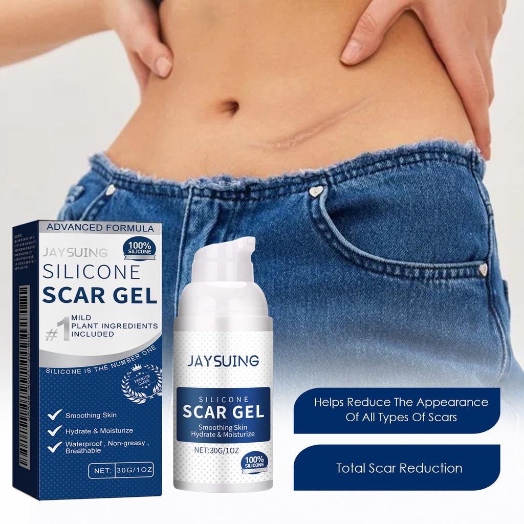 Jaysuing Scar Repair Gel For Fading Pregnancy And Surgical Scars Smooth Nourishing Skin
