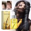 EELHOE Anti-Hair Loss Essence Oil 35ml Hair Growth Rapid Treatment, Prevent Hair Thinning, Drying, Curl Repai,Anti-dandruff