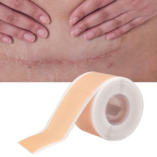 Эффективная наклейка на шрам, умеренный самоклеящийся безопасный силиконовый лист для ремонта шрамов, здравоохранение