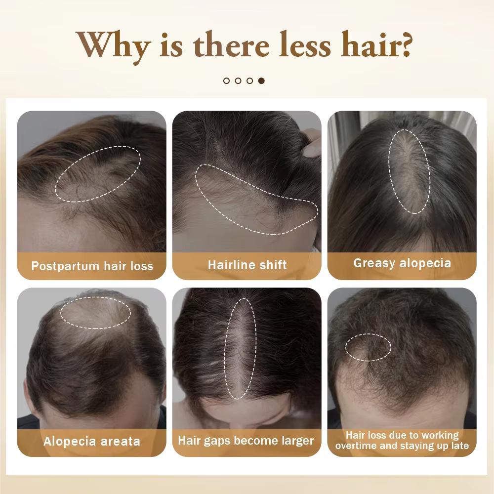 PURC Масло батана Спрей для роста волос Уход за волосами Против выпадения волос Быстрое восстановление роста Питательный спрей Масло розмарина Биотин Средства для роста волос