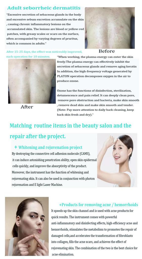 Professional Ozone Plasma Pen Machine for Alleviating Skin Aging Skin Rejuvenation Whitening Acne Treatment Plasma Pen
