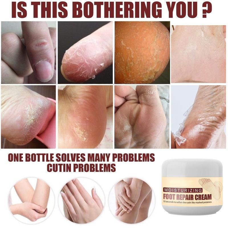 Foot Repair Cream Увлажняющий и восстанавливающий крем для ухода за ногами, шелушением пяток
