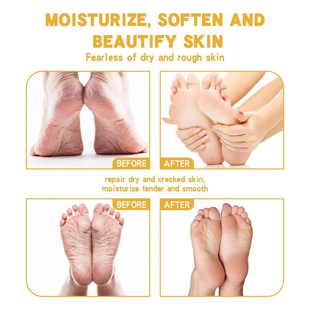 Gentle and Non-irritating, the Chapped Foot Repair Cream Hydrates and Nourishes the Skin, Leaving It Soft and Delicate