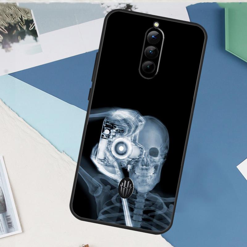 Эстетика рентгеновского искусства Череп Для Nubia Red Magic 10 9 8 Pro Plus 6 7 Pro 6S 7S 5G 6R Чехол Для RedMagic 8S 9S Pro Plus