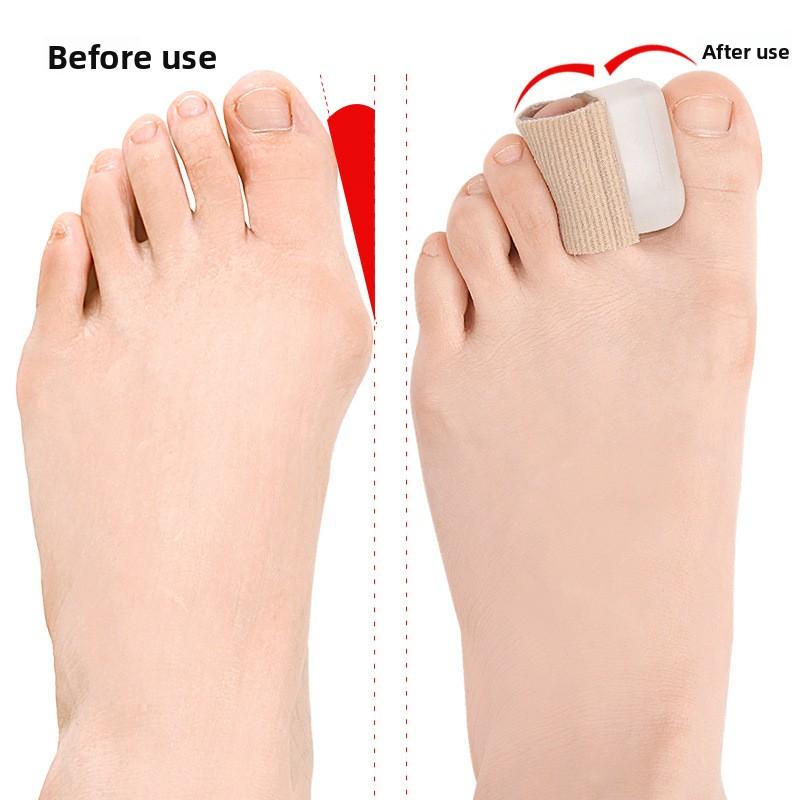 Разделитель пальцев ног для коррекции Hallux Valgus SEBS Мягкий разделитель пальцев для перекрывающихся, согнутых пальцев ног Облегчение