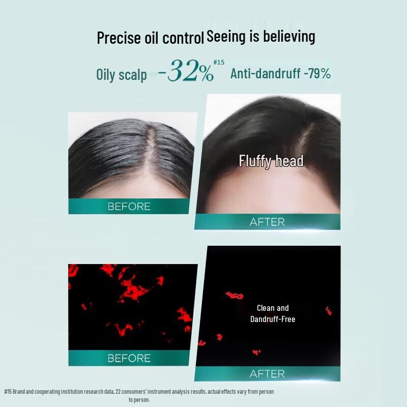 L'Oréal Salicylic Acid Oil Control Anti-Dandruff Shampoo 440ml