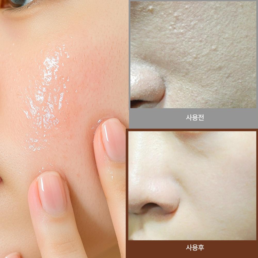IT:FU Chic Healer Ampoule Water Glow Увлажняющий Сияющий Бустер для Кожи PDRN Экзосома Стволовых Клеток Гиалуроновая Кислота MTS Коллаген EGF, 30 мл, 1 штука