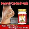 Natural Cracked Heels Repair Cream 55g - For Dry, Itchy, Peeling & Hard Skin - Intensive Moisturizing Foot & Hand Balm