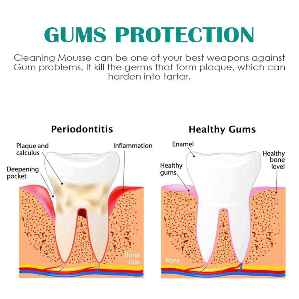 EELHOE Очищение зубов, отбеливающий мусс, зубная паста для глубокой очистки, пена, зубная паста удаляет пятна, свежее дыхание, инструменты для ухода за зубами, 30 мл