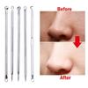 5 Pcs Blackhead Whitehead Pimple Spot Comedone Acne Extractor Remover Tool Kit