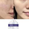 Face Skin Care Whitening Freckle Cream Remove Melasma Dark Spots Melanin Anti-Aging Lightening Shrink Pores Moisturizing