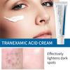 Крем Tranexamic Anti-freckle Cream 50 мл Устраняет хлоазму, увлажняет и питает, улучшает тусклость и осветляет тон кожи