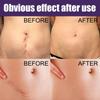 Eelhoe Silicone Scar Patches For Reducing Pregnancy And C-section Scars Effectively